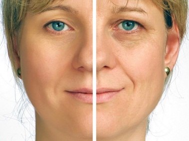 Особенности кремов для глаз после 50 лет